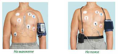 "Варианты крепления монитора артериального давления и электрокардиосигналов SDM23"